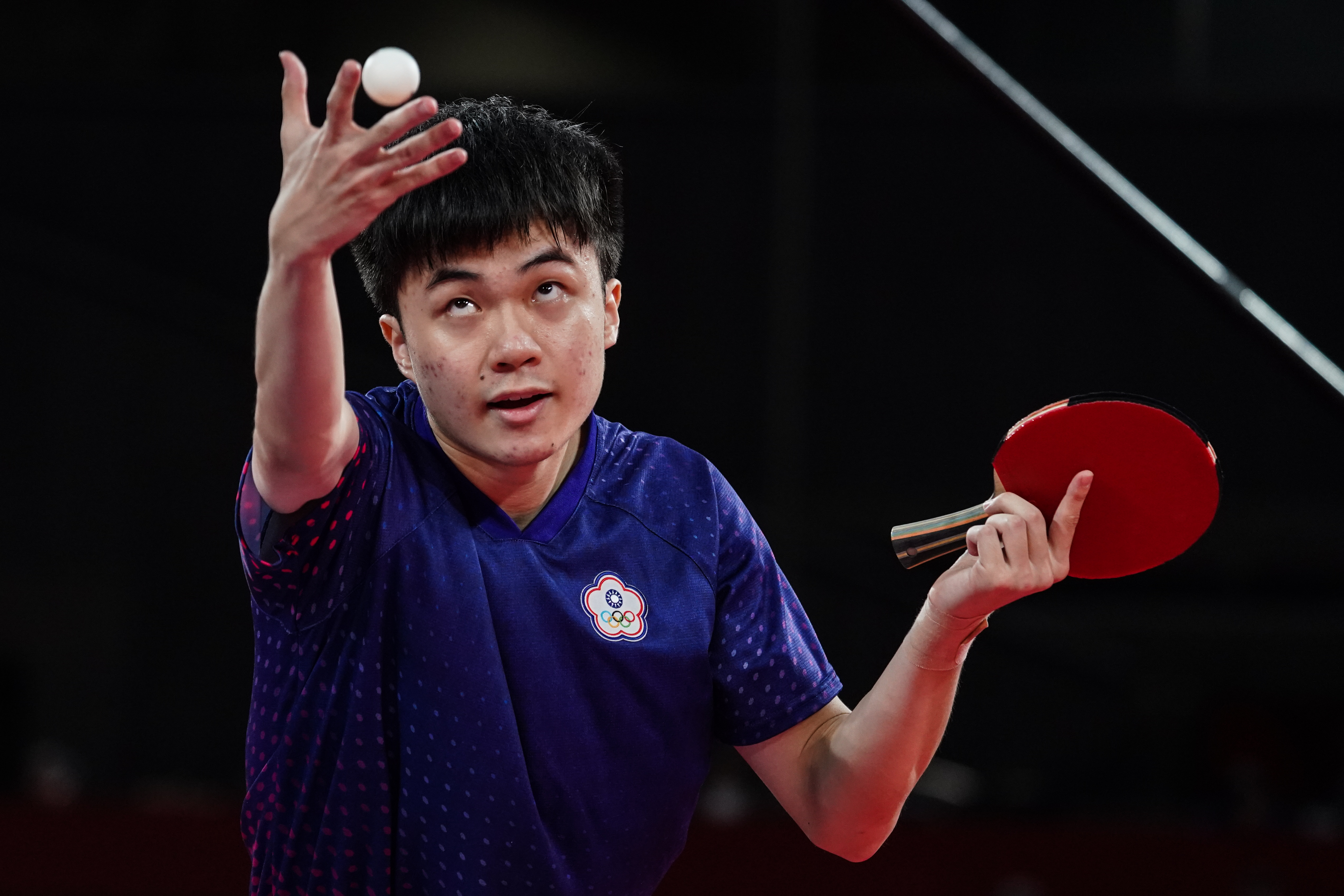 鼻骨骨折 鼻骨骨折